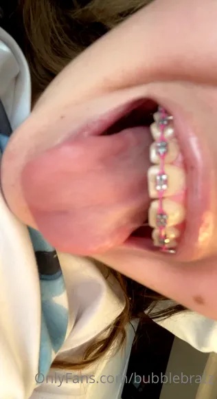 Bubblebratz Exclusive Leaked Nude Onlyfans #688680