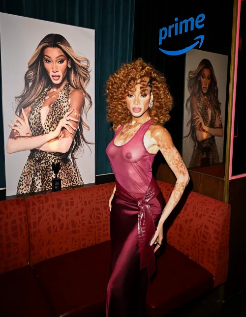 winnieharlow