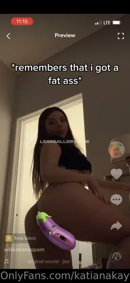 Kandi_kayxxx Exclusive Leaked Nude Onlyfans #2028117