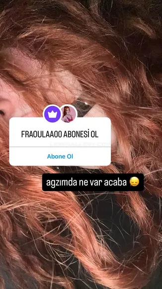 Fraaoula Exclusive Leaked Nude Onlyfans #543290