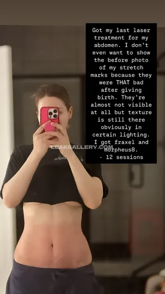 Pnkysparkles Exclusive Leaked Nude Onlyfans #904716