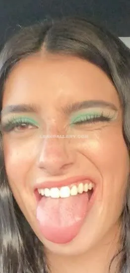 Dixiedamelio Exclusive Leaked Nude Onlyfans #2131555