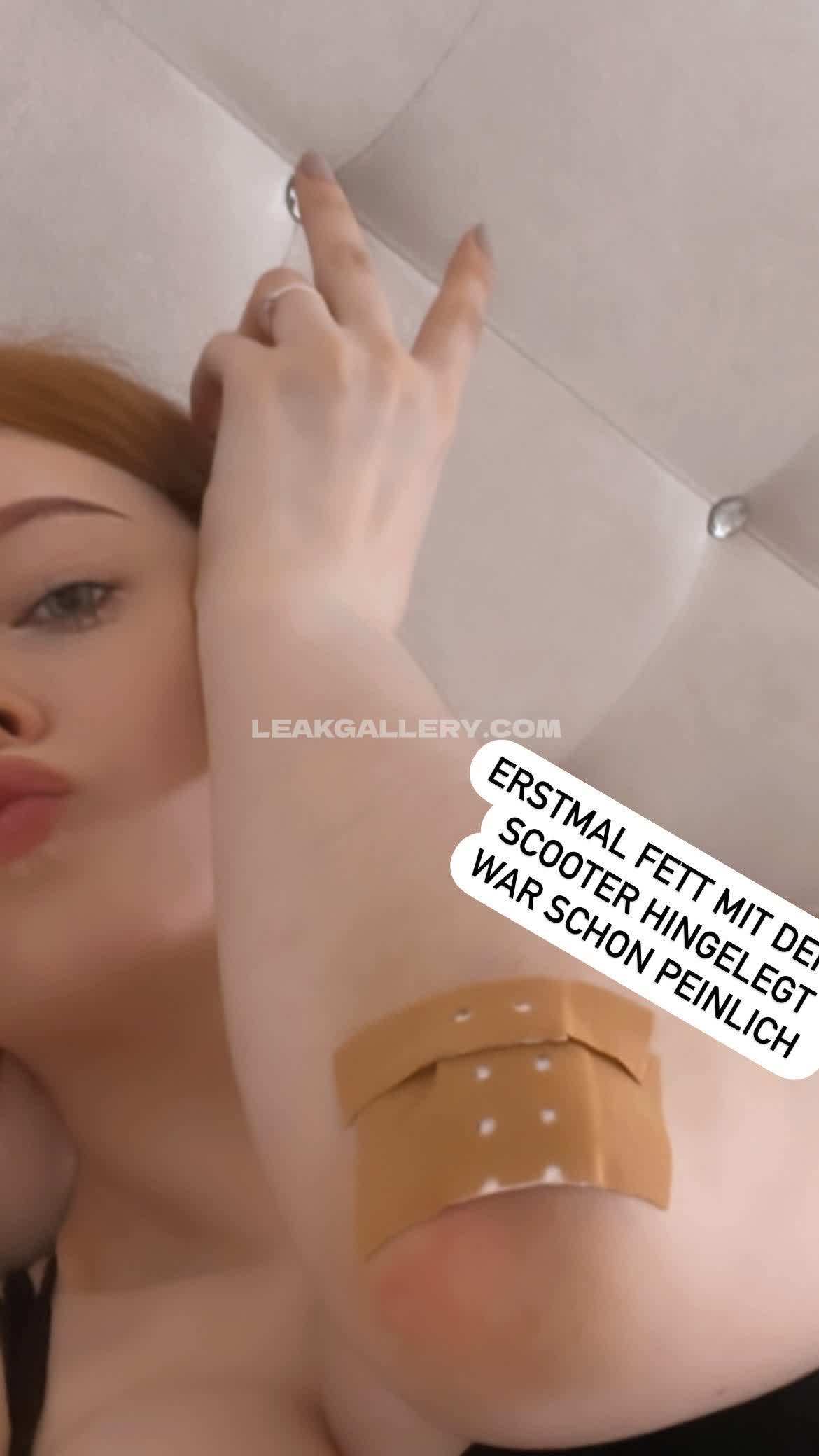 Kdrkitten Exclusive Leaked Nude OnlyFans #7736413
