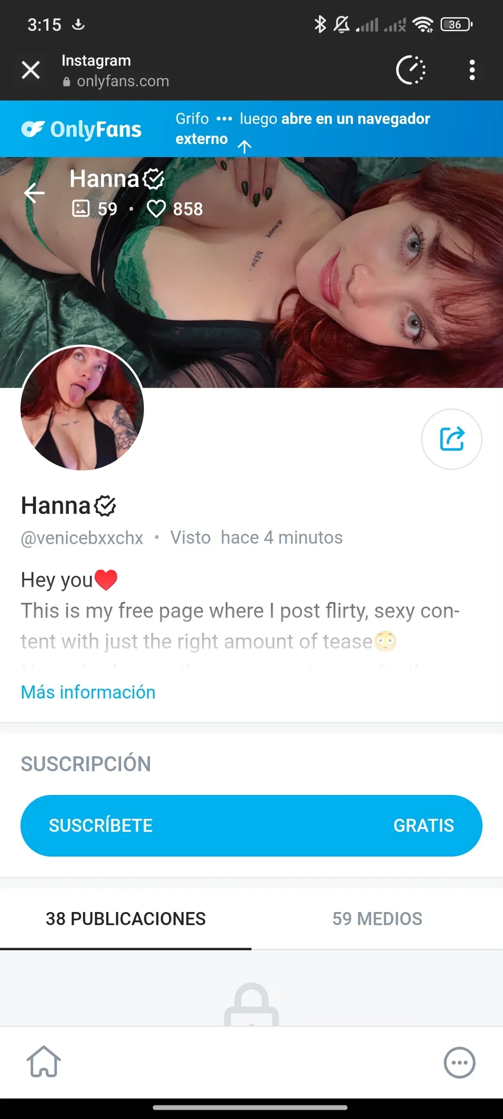 Acitrica Exclusive Leaked Nude OnlyFans #13605362