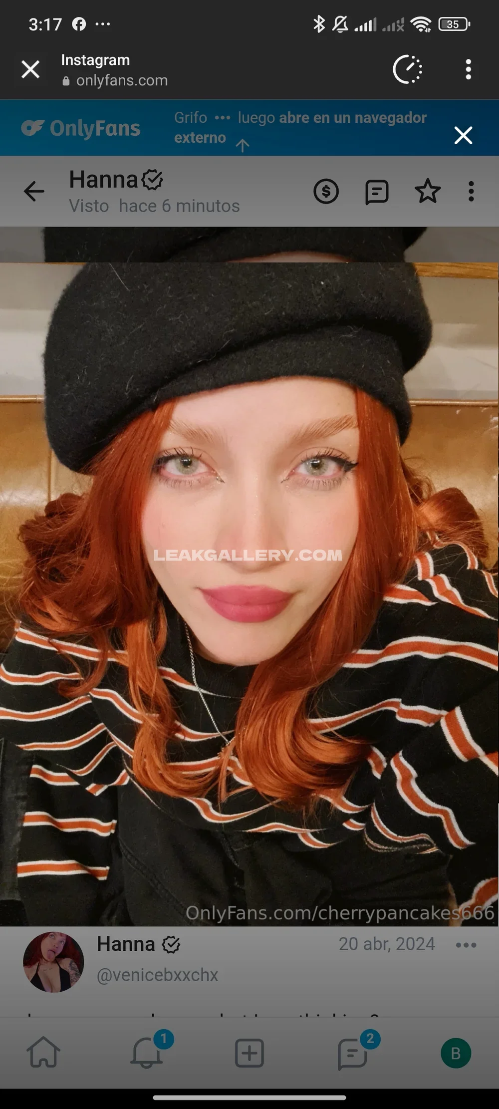 Acitrica Exclusive Leaked Nude OnlyFans #13605383