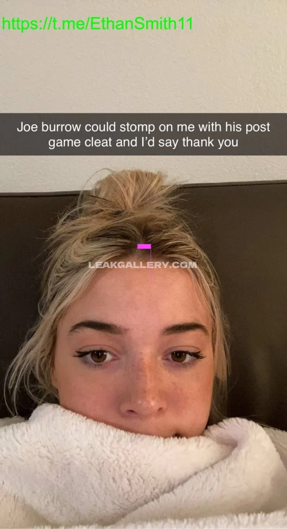 Livvydunne Freckled Face Close Up OnlyFans Photo Leaked