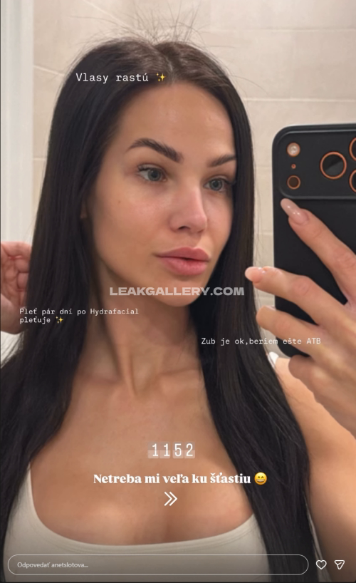 Anetslotova Exclusive Leaked Nude OnlyFans #11302476
