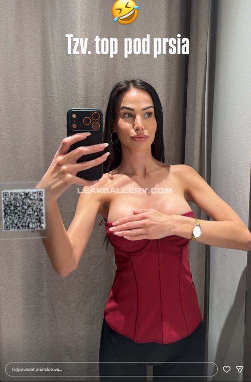 Anetslotova Exclusive Leaked Nude OnlyFans #11333754