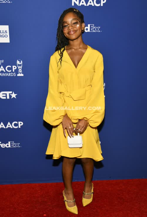 Marsaimartin Exclusive Leaked Nude OnlyFans #11210716