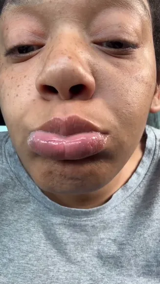 Cherlynnreels Lips Popping Wet Kiss OnlyFans Video Leaked