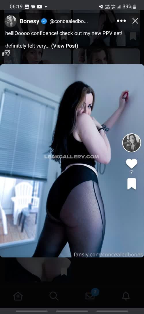 Concealedbones Exclusive Leaked Nude OnlyFans #14884704