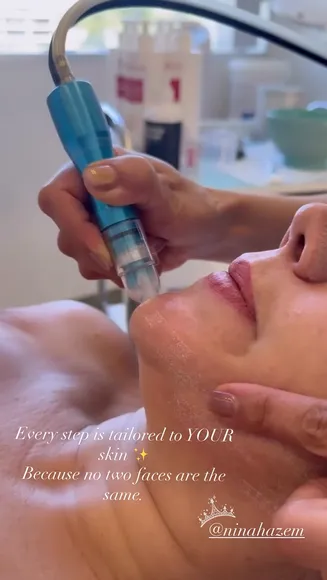 Ninahazem Facial Treatment Tools OnlyFans Video Leaked