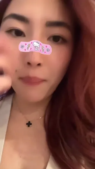 Xchocobars Bandage Over Nose OnlyFans Video Leaked