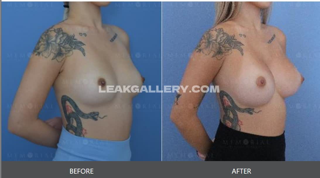 Yoshibaby Exclusive Leaked Nude OnlyFans #12667192